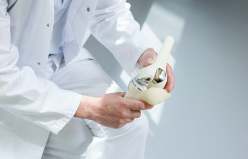 Orthopedic doctor holds joint replacement model