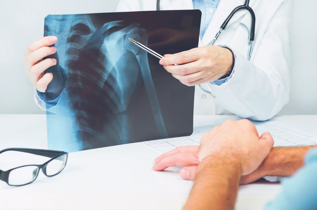 Orthopedic doctor reviews injured shoulder scans with patient